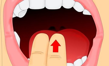 отравиться-0