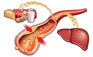 cholesterol-metabolism