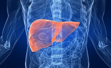 cirrhosis