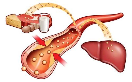 cholesterol-metabolism